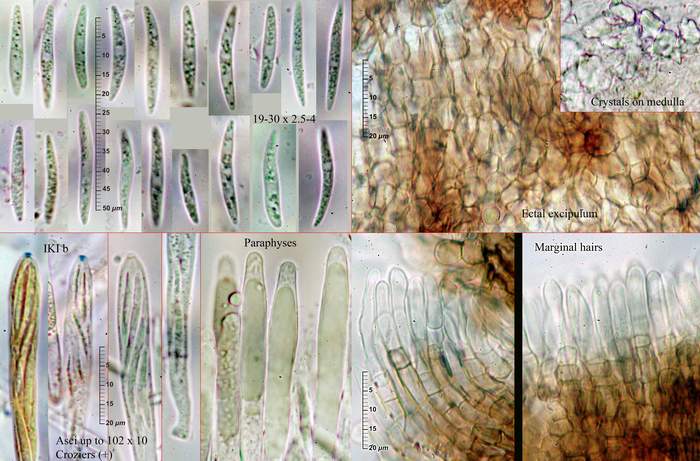 macrostoma