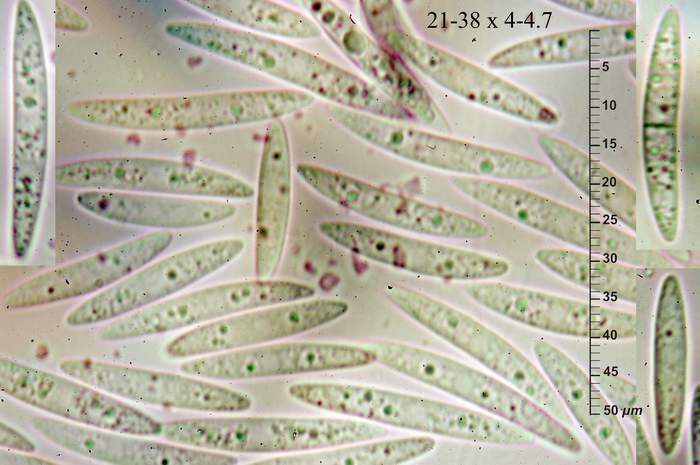 macrostoma