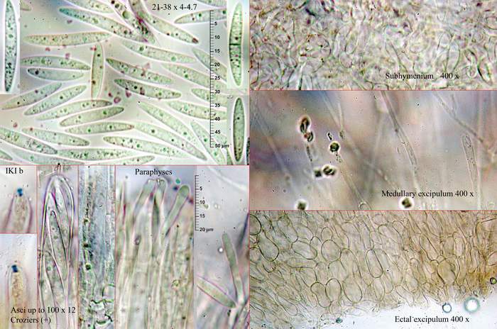 macrostoma