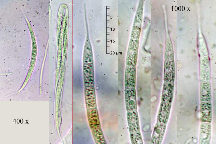 macrostoma