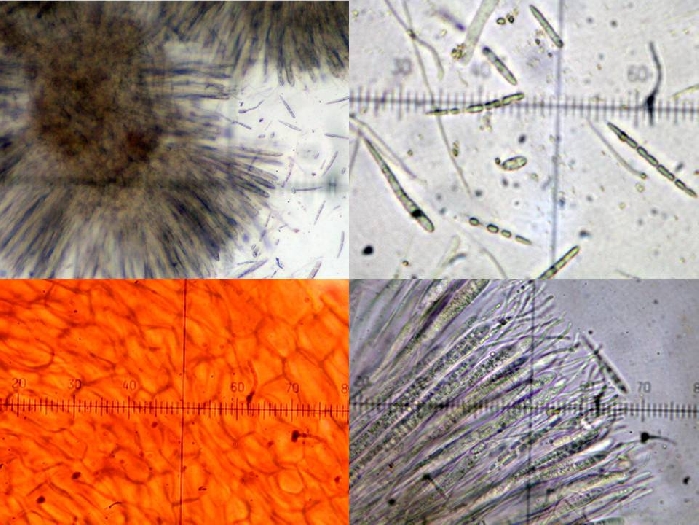 macrostoma