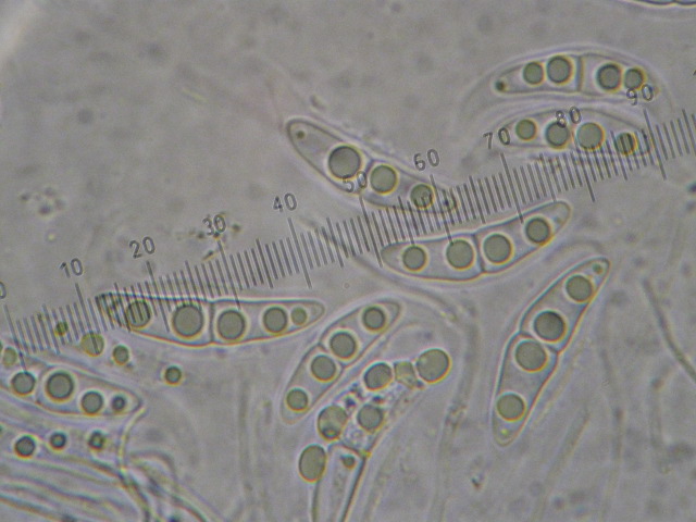 macrostoma