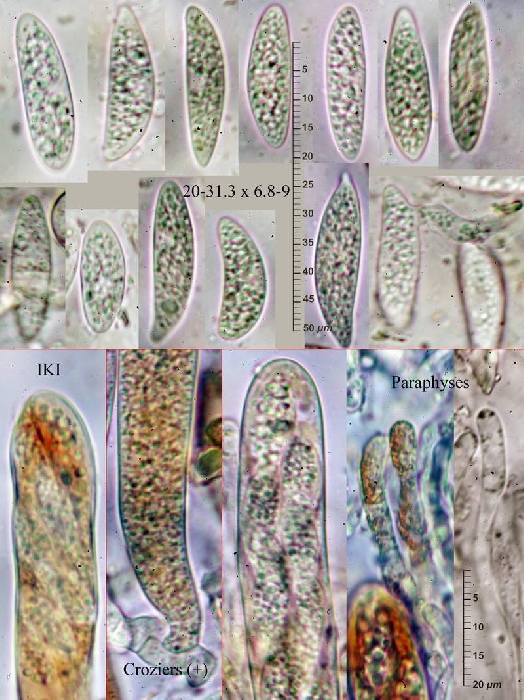 macrostoma
