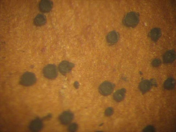 macrostoma