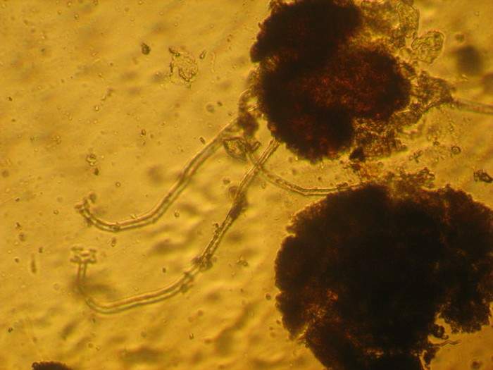 macrostoma