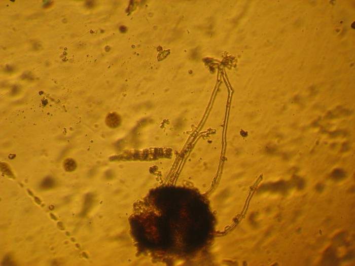 macrostoma