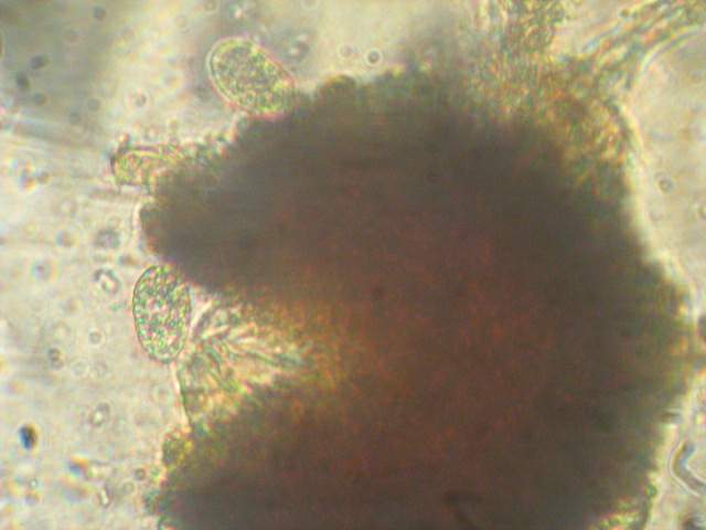 macrostoma