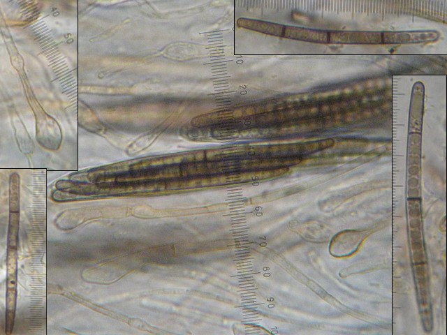 macrostoma