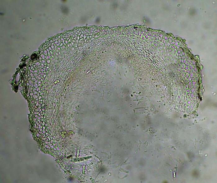 macrostoma