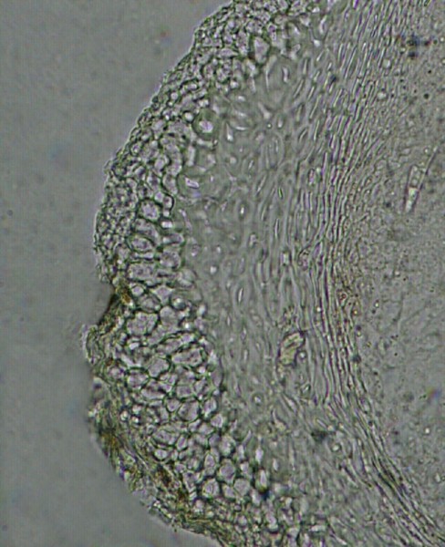 macrostoma