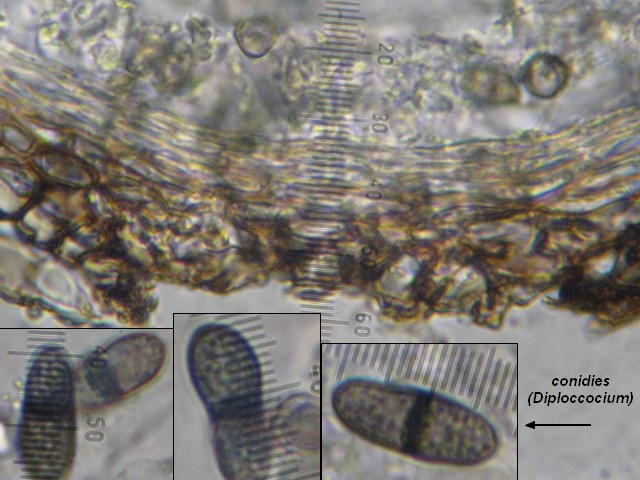 macrostoma