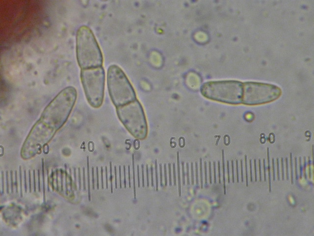 macrostoma