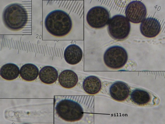 macrostoma