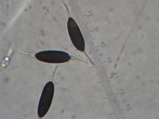macrostoma