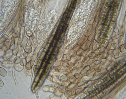 macrostoma