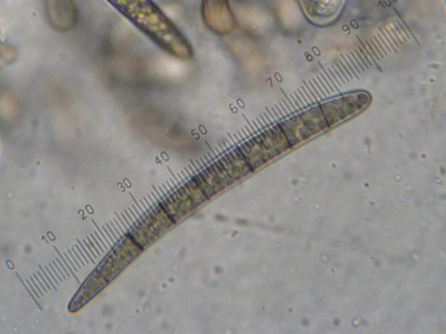 macrostoma