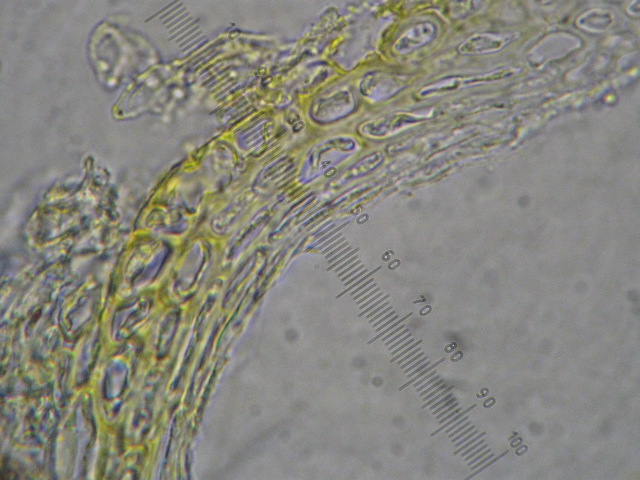 macrostoma