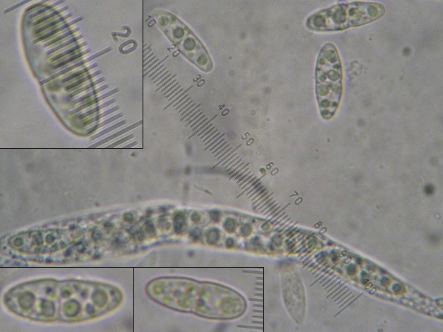 macrostoma