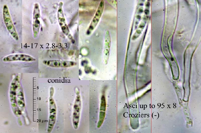 macrostoma