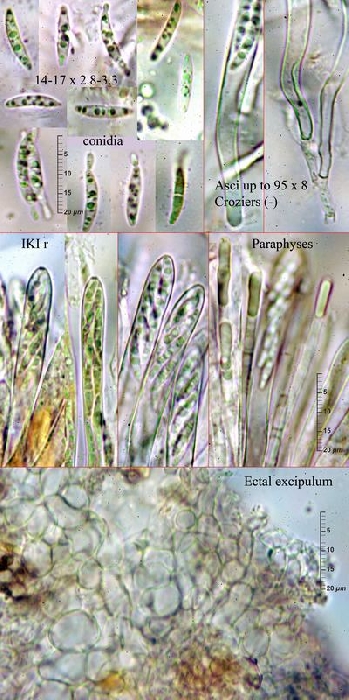 macrostoma
