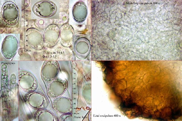 macrostoma