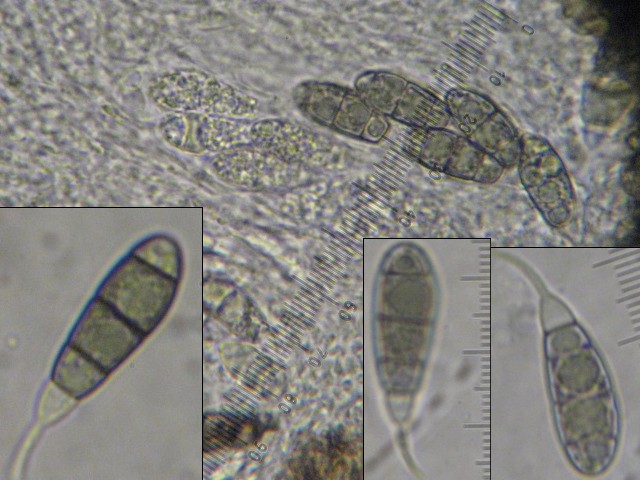 macrostoma