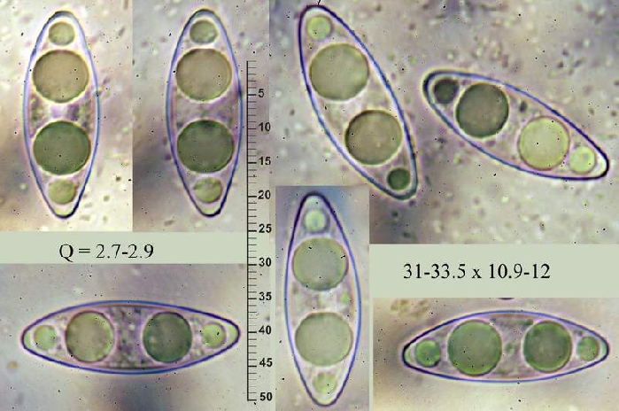 macrostoma
