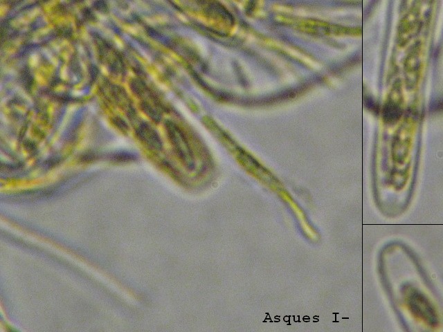 macrostoma