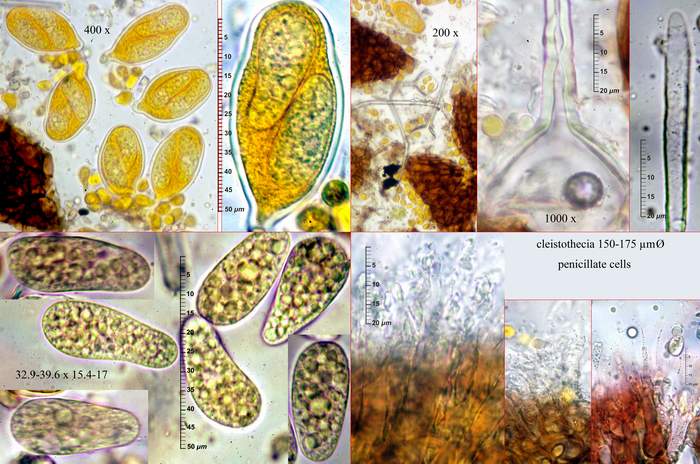 macrostoma
