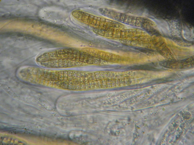 macrostoma