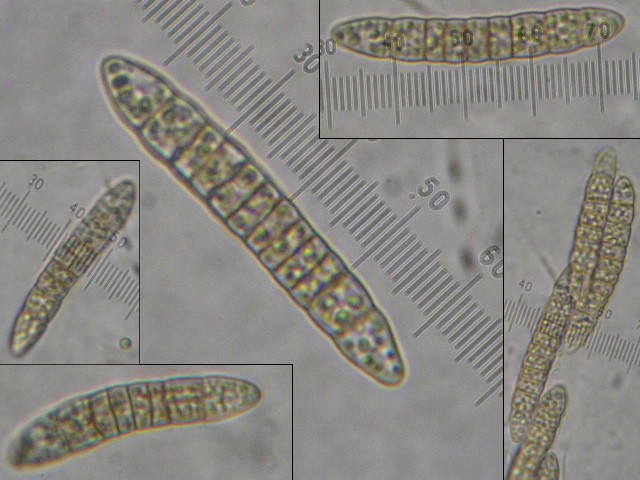 macrostoma