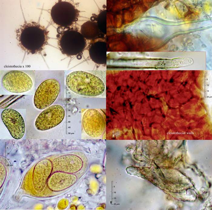 macrostoma