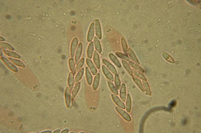 macrostoma