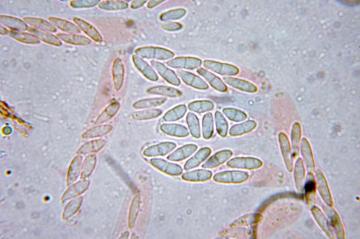 macrostoma