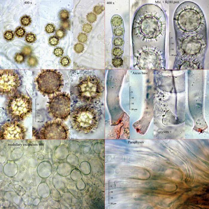 macrostoma