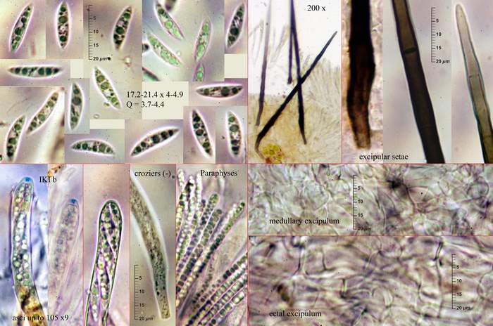 macrostoma