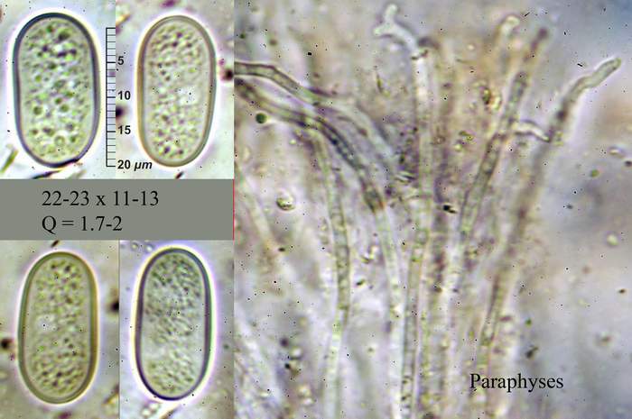 macrostoma