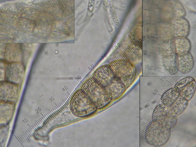 macrostoma