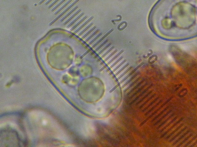 macrostoma
