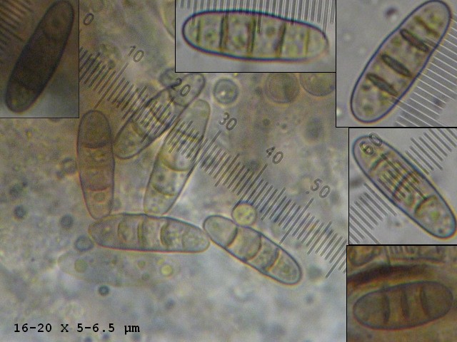 macrostoma