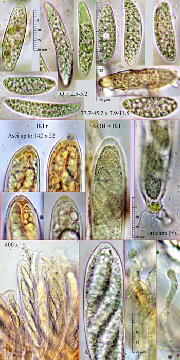 macrostoma