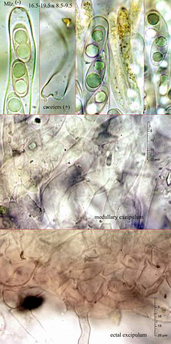 macrostoma
