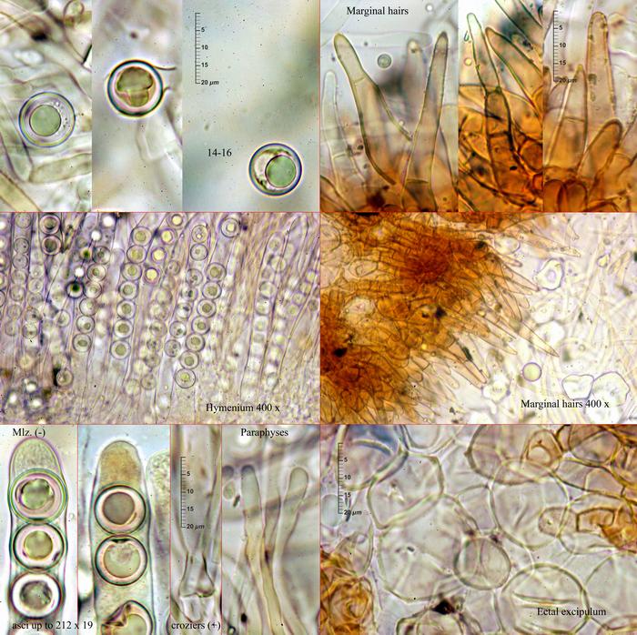 macrostoma