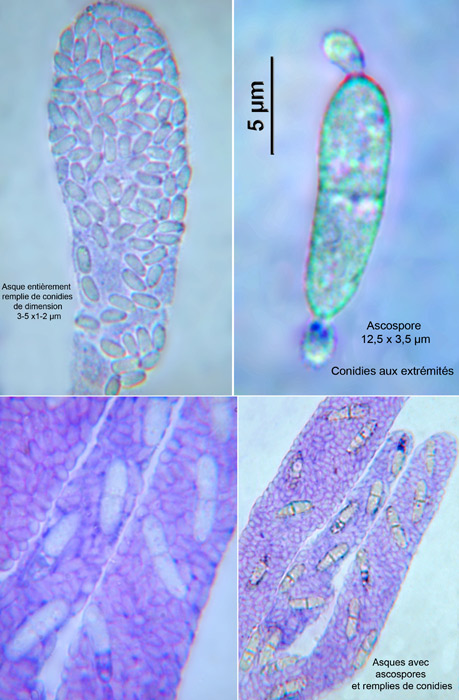 macrostoma