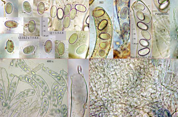 macrostoma
