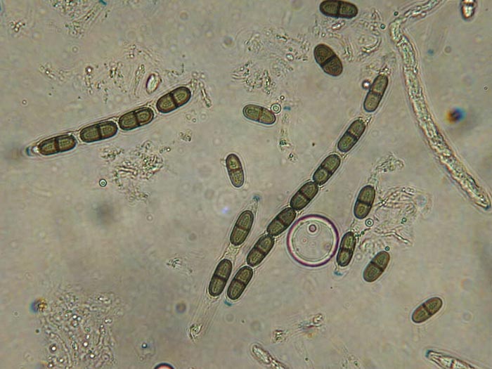 macrostoma