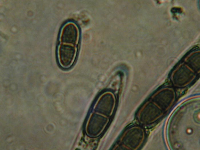 macrostoma