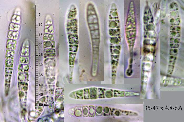 macrostoma