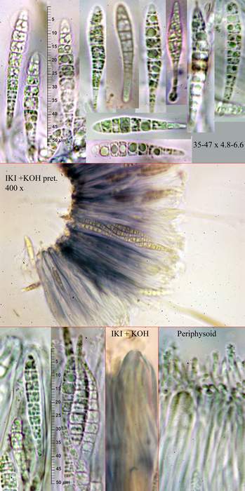 macrostoma