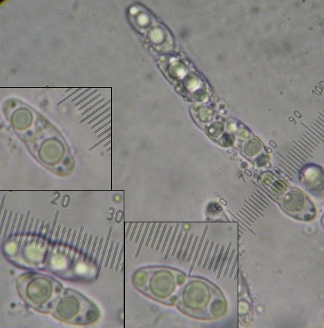 macrostoma
